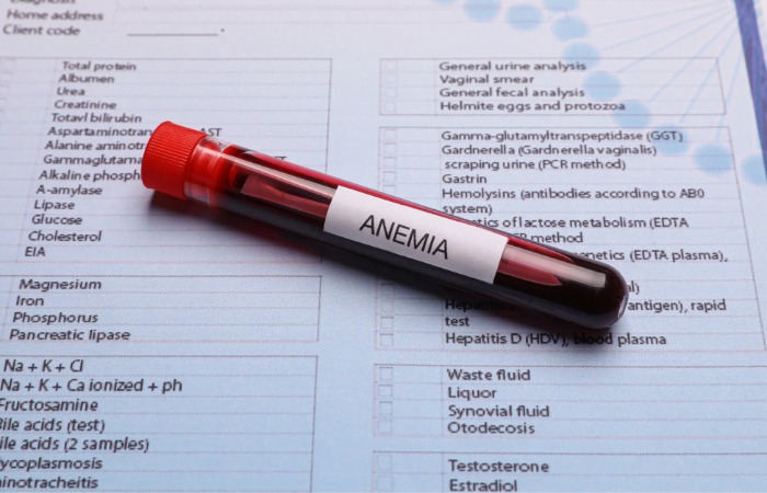 anemia affects